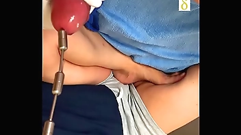 My wife Pia Inserting an Urethra Chain into my bladder Part01